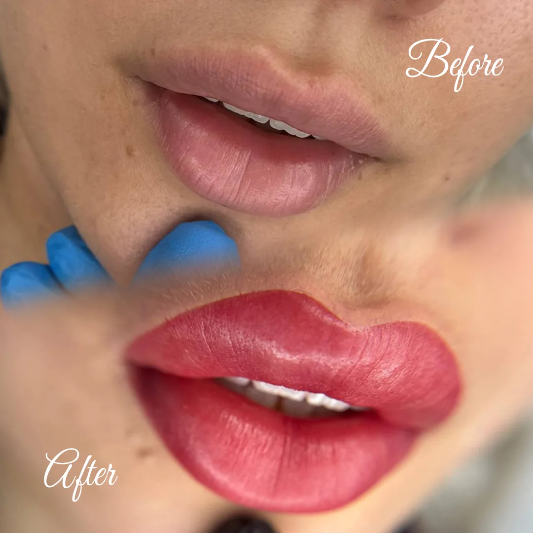 Dudak Renklendirme (Lip Blush)